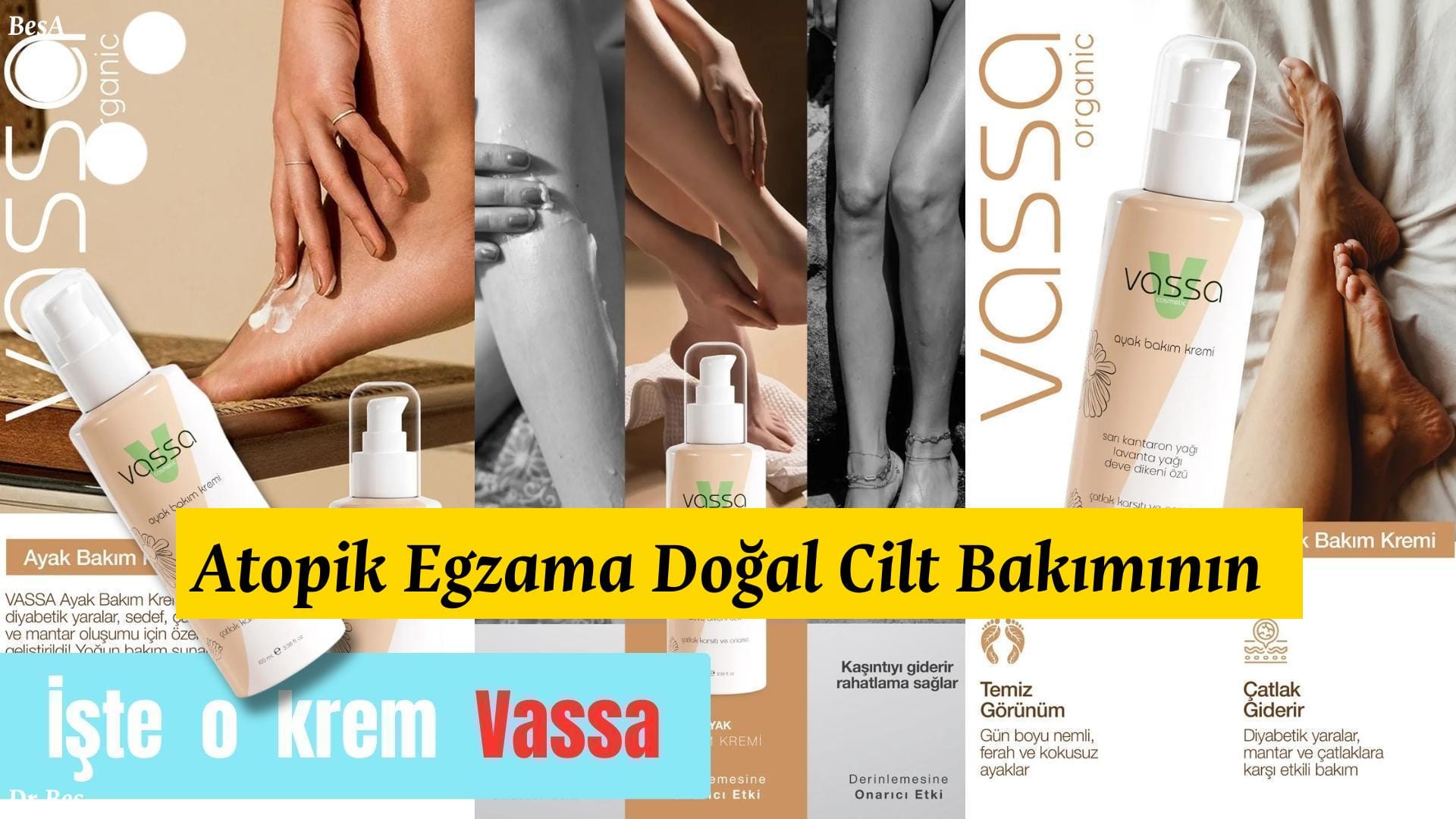 Atopik Egzama Doğal Cilt Bakımının Şifreleri