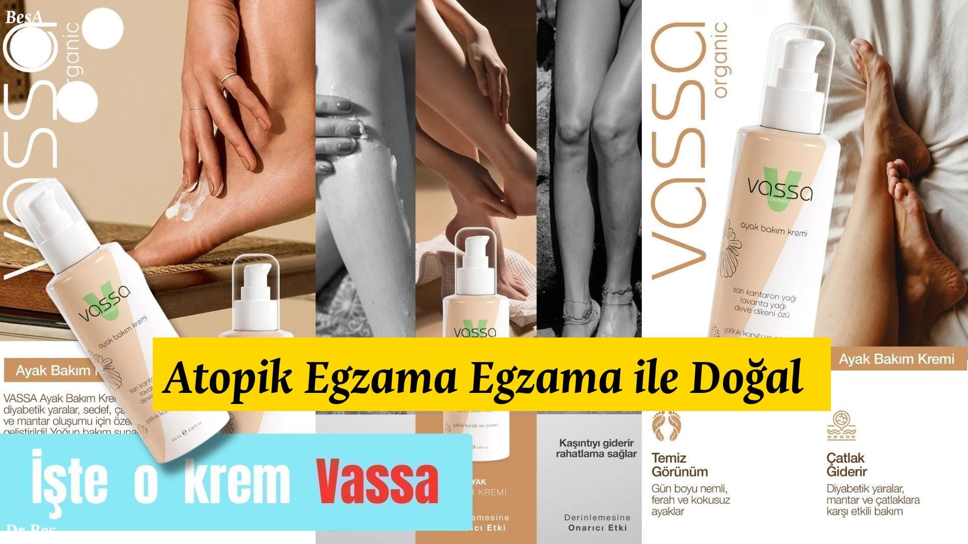 Atopik Egzama Egzama ile Doğal Çözüm Yöntemleri