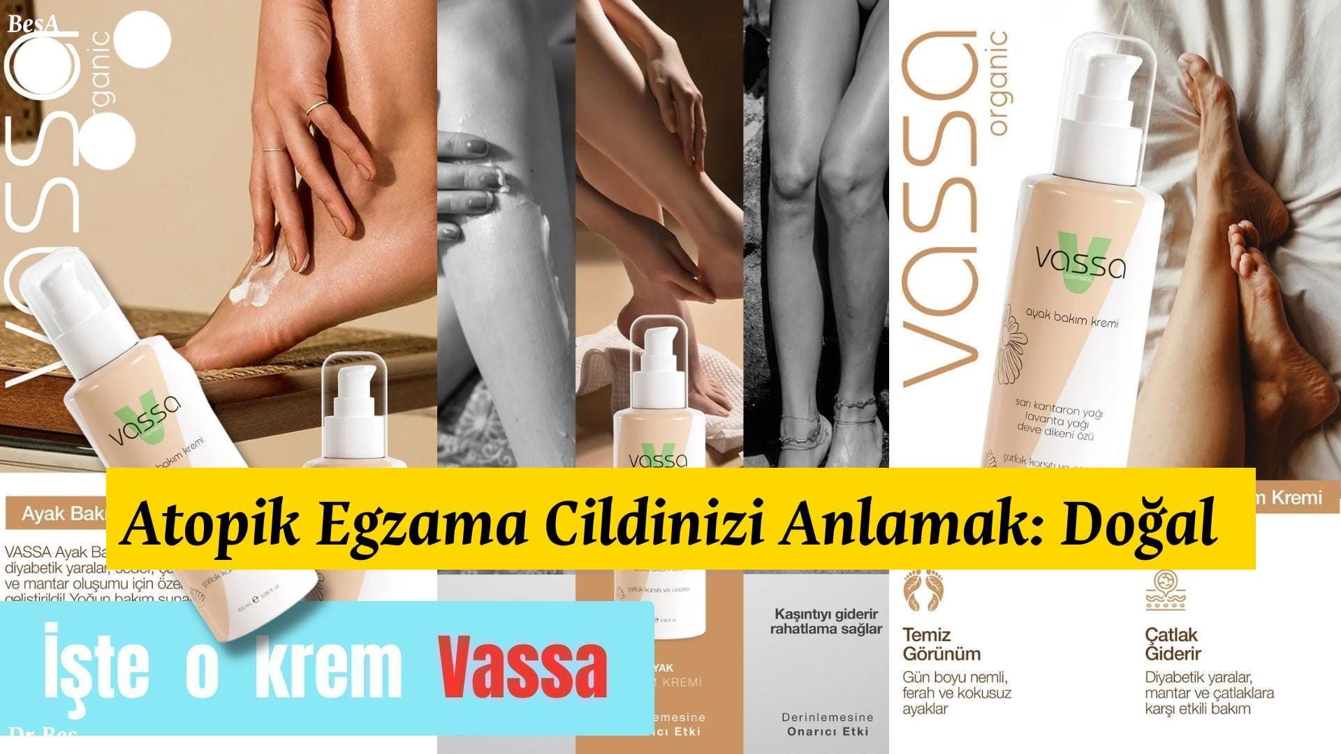 Atopik Egzama Cildinizi Anlamak: Doğal Çözüm Yolu