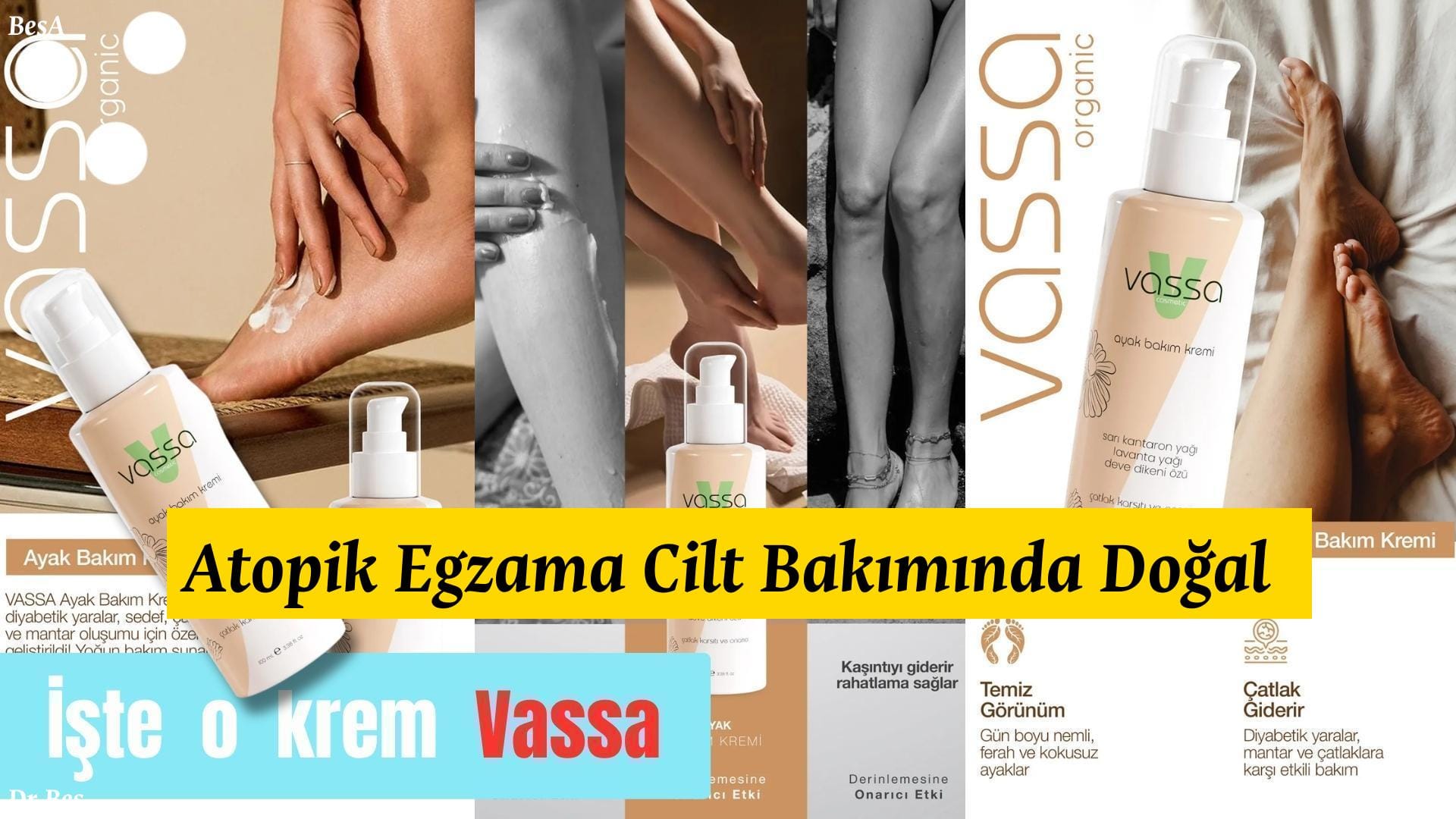 Atopik Egzama Cilt Bakımında Doğal Çözümler