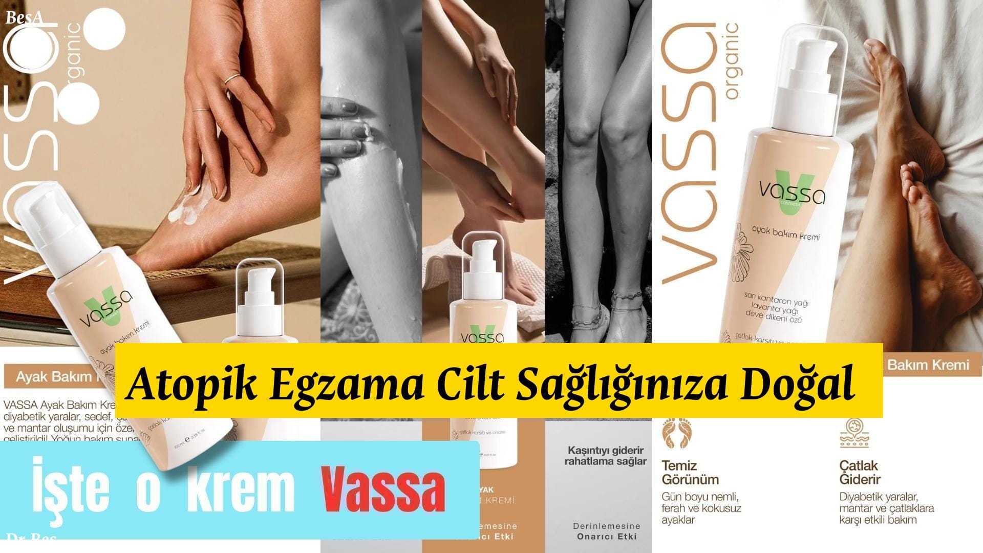 Atopik Egzama Cilt Sağlığınıza Doğal Dokunuşlar