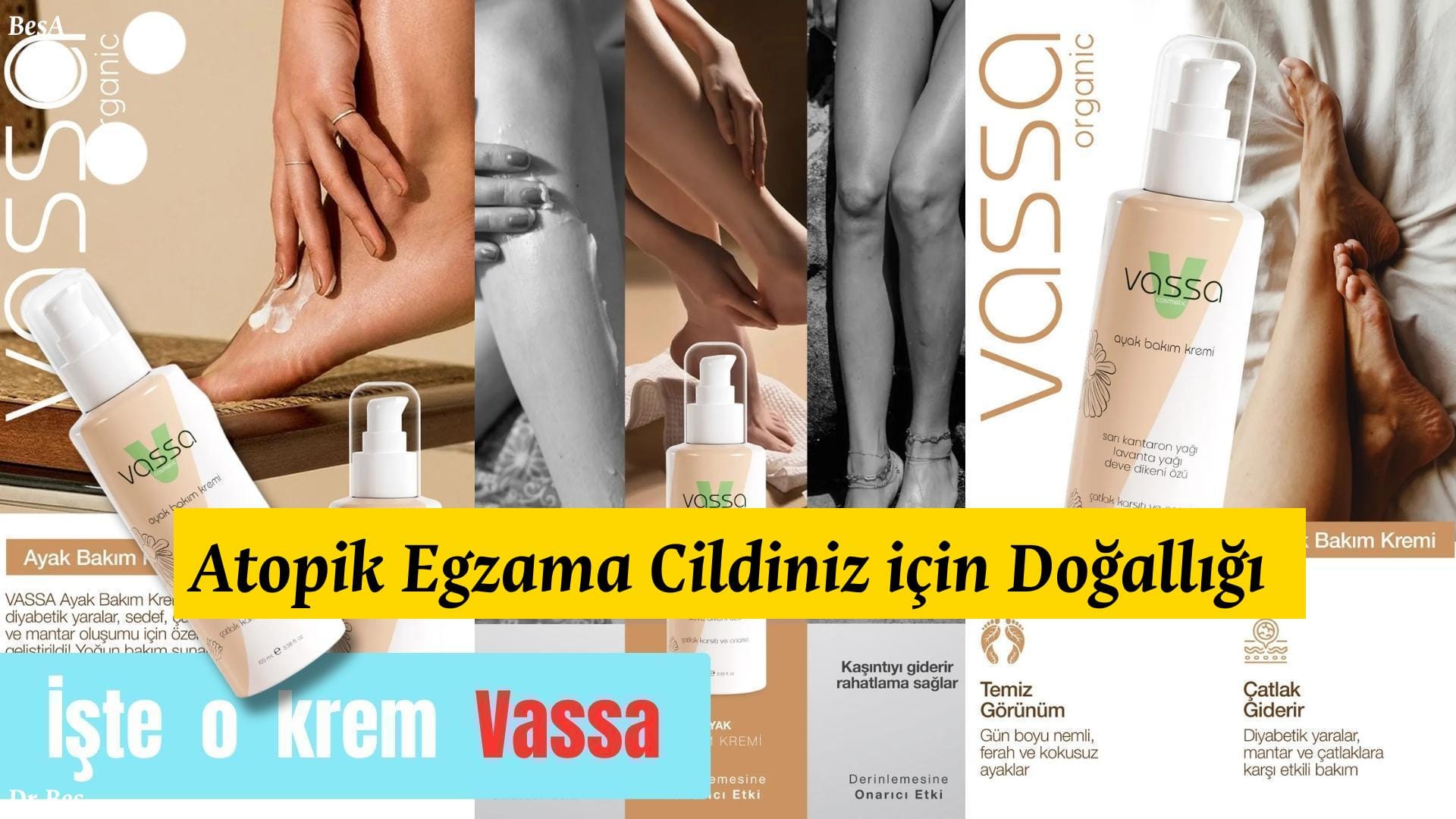 Atopik Egzama Cildiniz için Doğallığı Keşfedin!