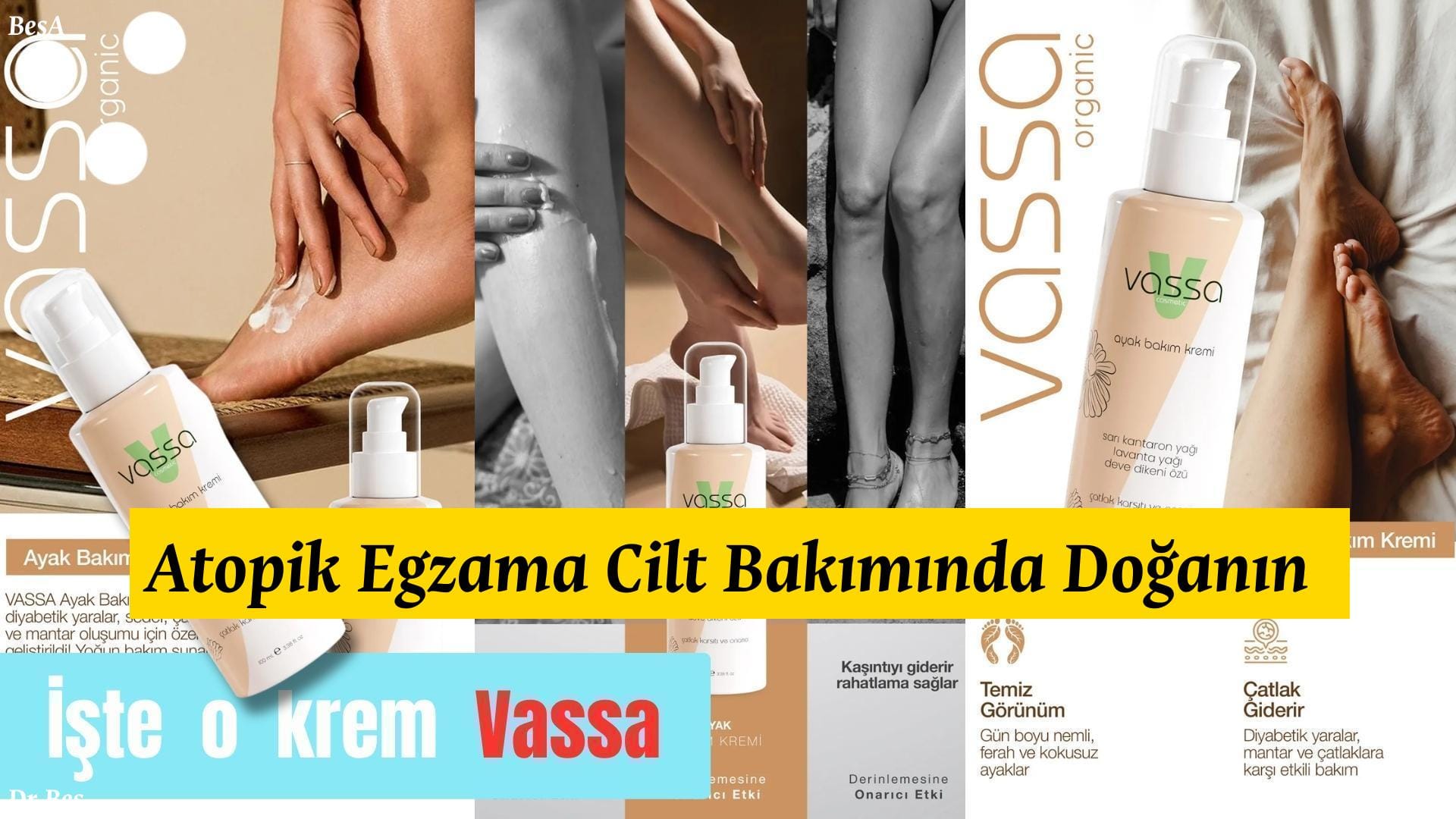 Atopik Egzama Cilt Bakımında Doğanın Gücü