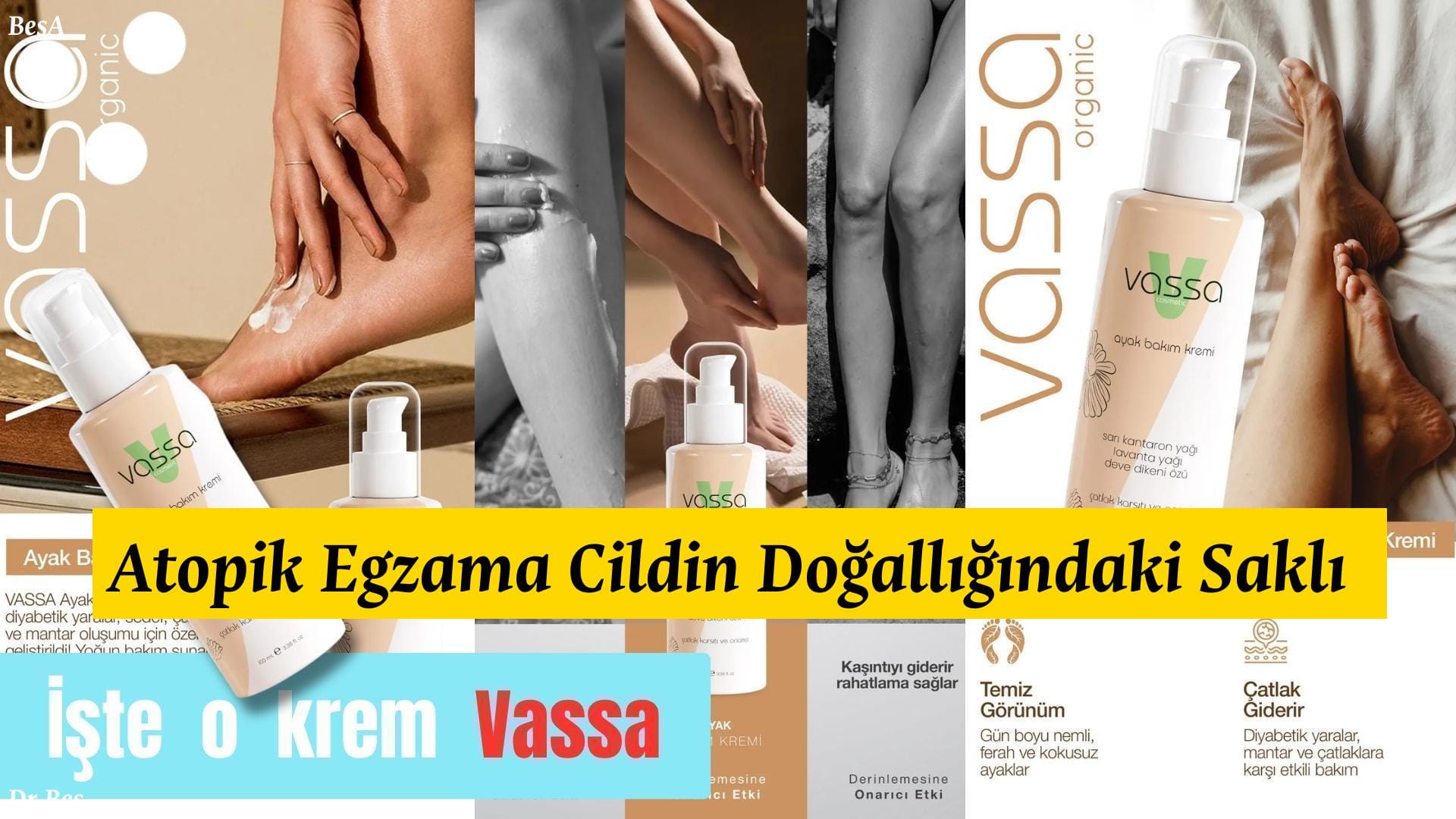 Atopik Egzama Cildin Doğallığındaki Saklı Sır